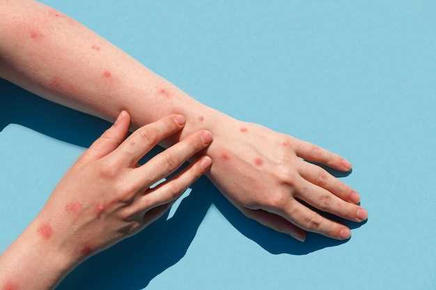 Аллергия на коже: симптомы и диагностика