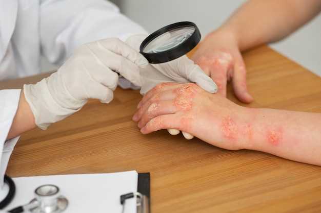 Грибок или дерматит: как определить и как лечить