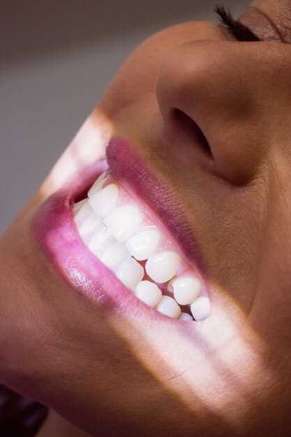 Примеры фото до и после протезирования передних зубов