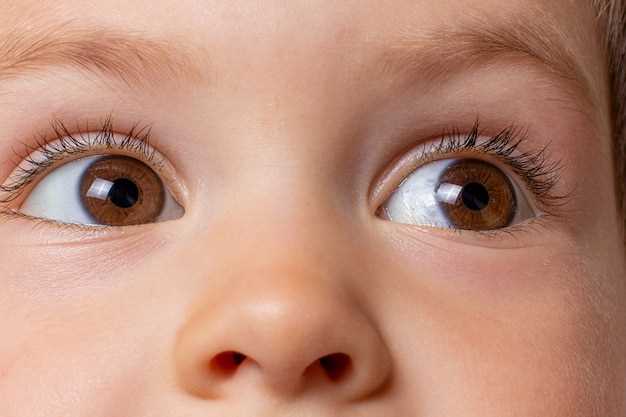Влияние болезней на появление пятен под глазами у детей