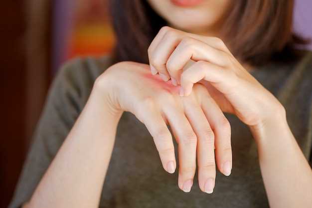 Лечение шелушения кожи на кончиках пальцев