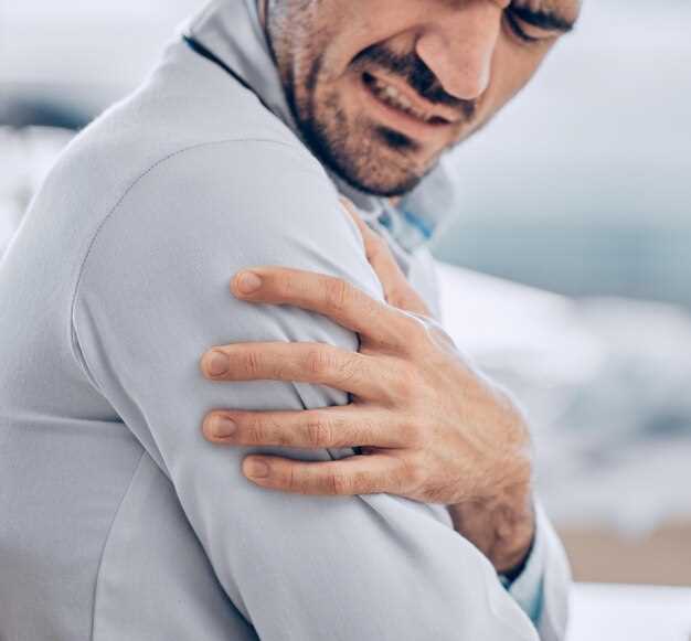 Синдром замороженного плеча: все, что нужно знать