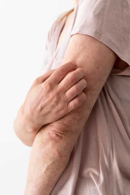 Сыпь на теле от нервов: причины и современные методы лечения