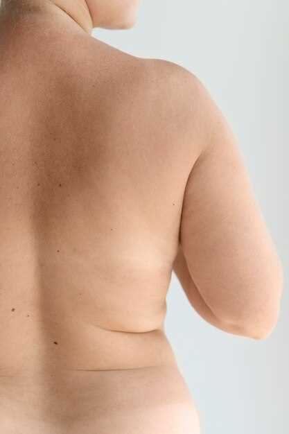 Какие симптомы говорят о наличии сыпи на груди?