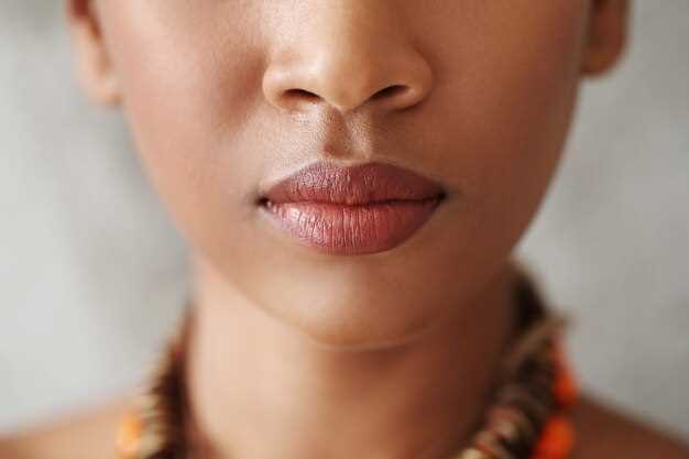 Темные пятна на половых губах: причины, симптомы и методы лечения