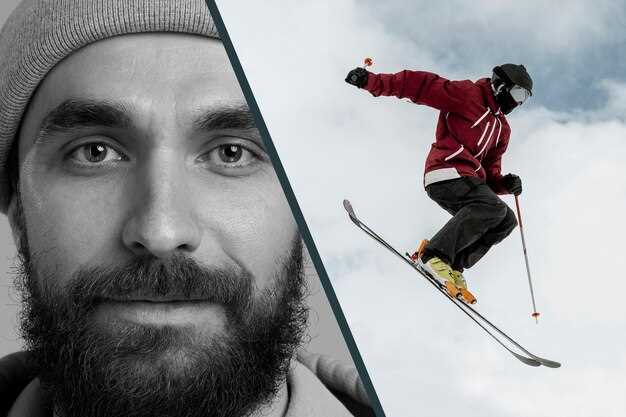 История развития лыжного спорта
