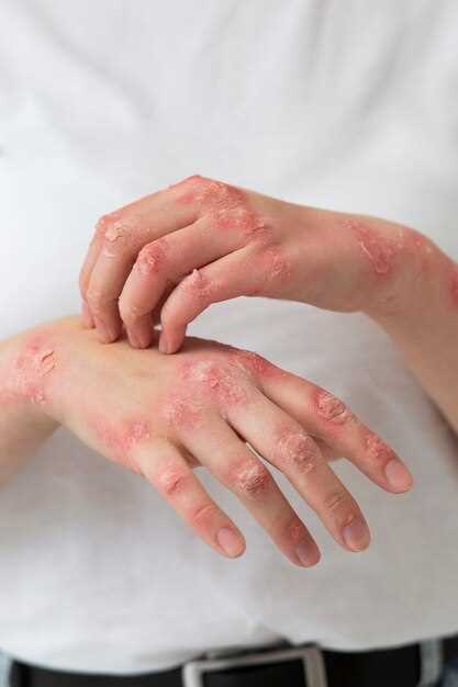 Желтое пятно на руке: причины и методы лечения