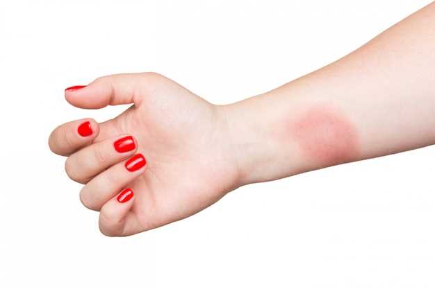 Зуд и покраснение на пальце: причины и лечение